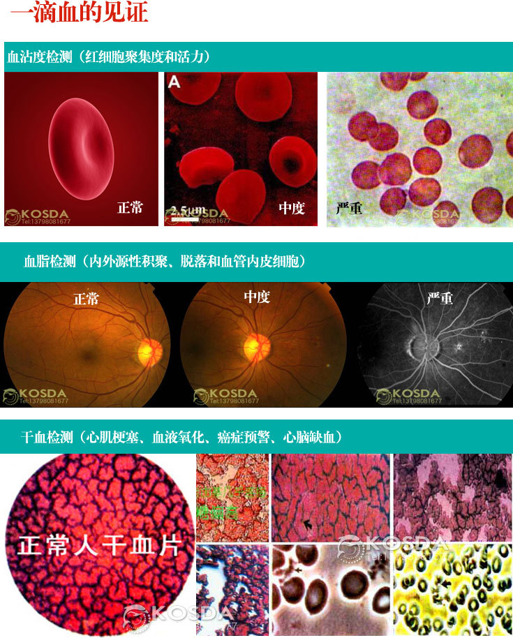 双人负离子细胞排毒仪 足部泡脚排毒仪 桑拿足浴设备厂家特价直销